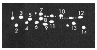 Proteasome 20S α1, 2, 3, 5, 6 & 7 subunits monoclonal antibody (MCP231) Western Blot
