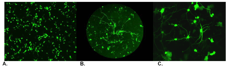 Nupherin™ Transfection Reagent image