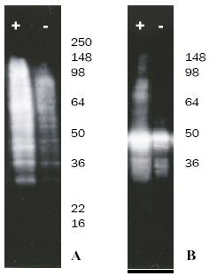Ubiquitin conjugating kit (HeLa lysate-based) Western blot