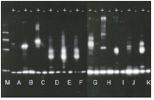 Ubiquitinylation kit Western blot