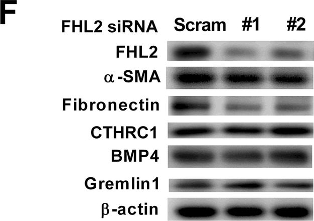 BML-FG6010 Fibronectin (cellular) (human) monoclonal antibody (DH1) Western Blot Human 5