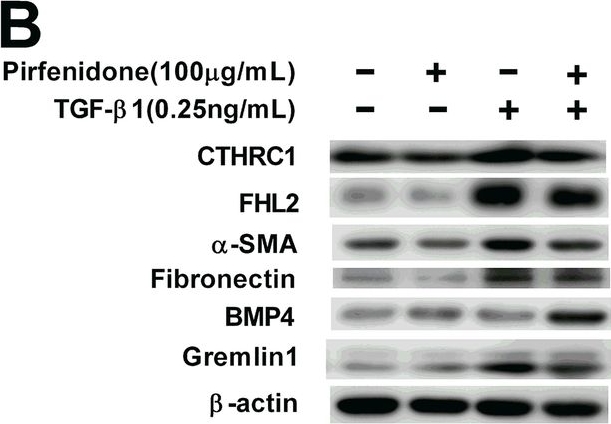 BML-FG6010 Fibronectin (cellular) (human) monoclonal antibody (DH1) Western Blot Human 1