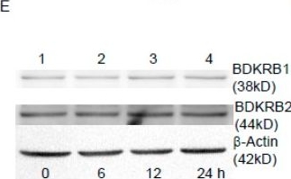 ADI-905-787 Bradykinin receptor B1 polyclonal antibody Western Blot Human 1