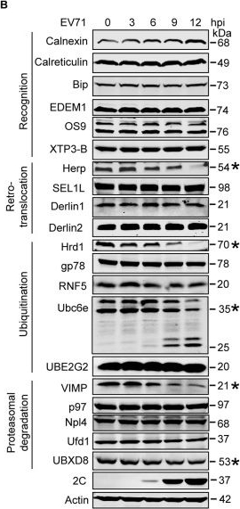 BML-PW9705 HERP (human) polyclonal antibody Western Blot Human 5