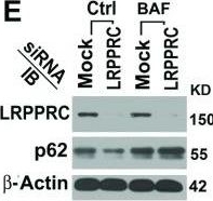 BML-PW9860 p62 (human) polyclonal antibody Western Blot Human 1