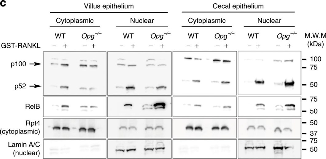 BML-PW8830 Proteasome 19S Rpt4/S10b subunit monoclonal antibody (p42-23) Western Blot Mouse 1