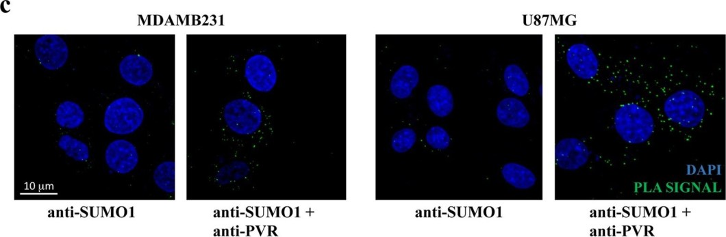BML-PW9460 SUMO-1 (human) (CT) polyclonal antibody Proximity Ligation Assay Human 1