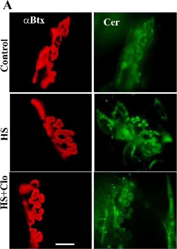ALX-804-196 Ceramide monoclonal antibody (MID 15B4) Immunohistochemistry Rat 1