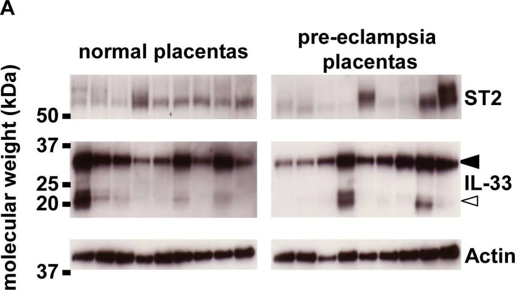 ALX-804-840 IL-33 monoclonal antibody (Nessy-1) Western Blot 1