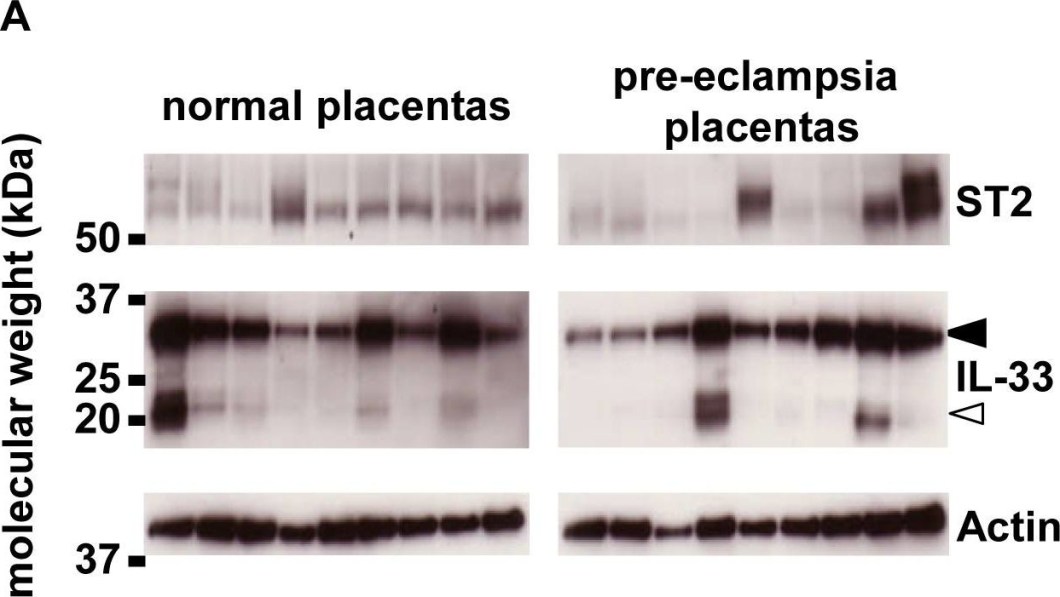 ALX-804-840 IL-33 monoclonal antibody (Nessy-1) Western Blot 1
