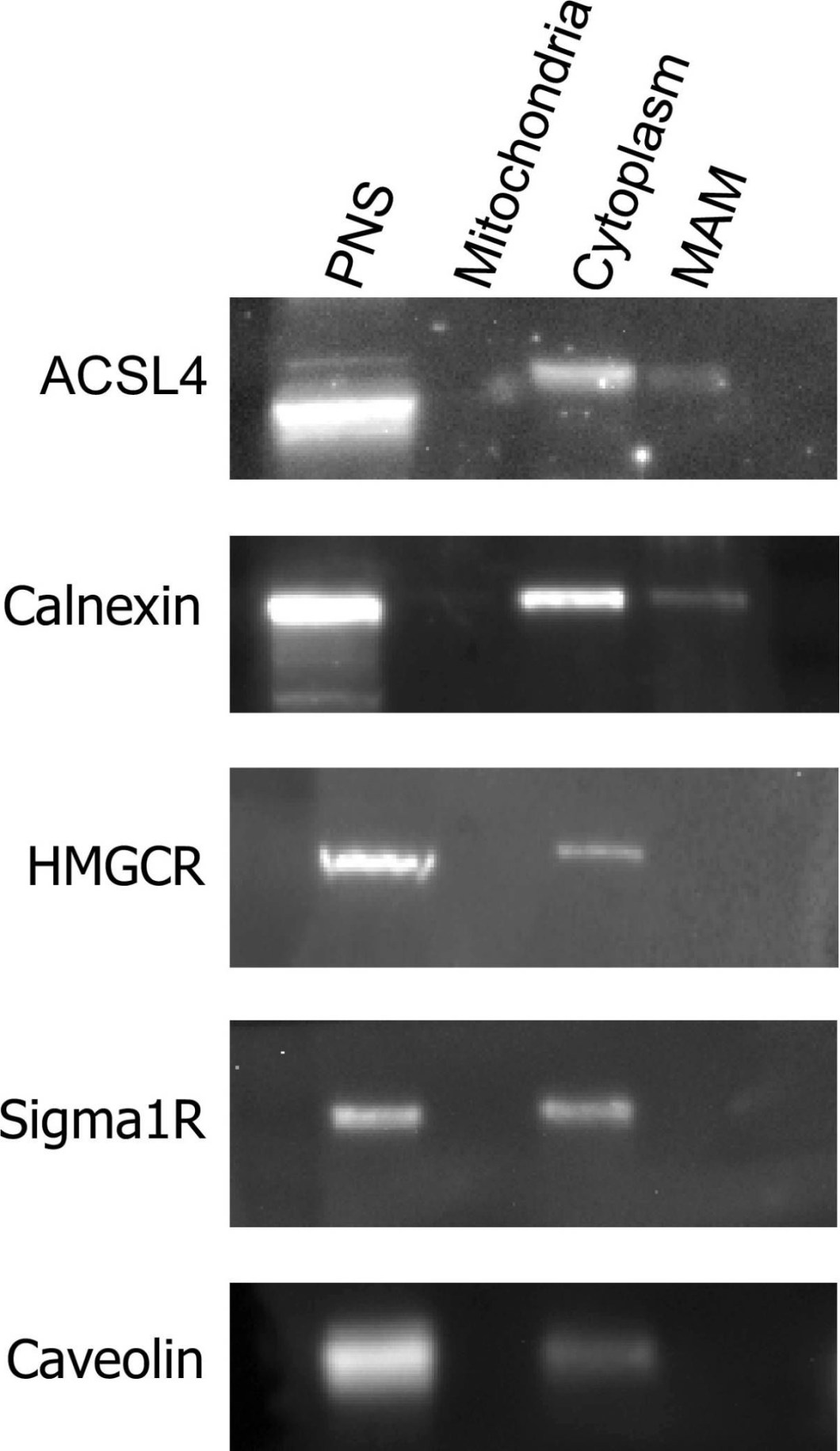 ADI-SPA-860 Calnexin polyclonal antibody Western Blot Human 3
