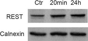 ADI-SPA-860 Calnexin polyclonal antibody Western Blot Mouse 31