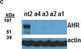 BML-SA550 AhR polyclonal antibody Western Blot Human 1