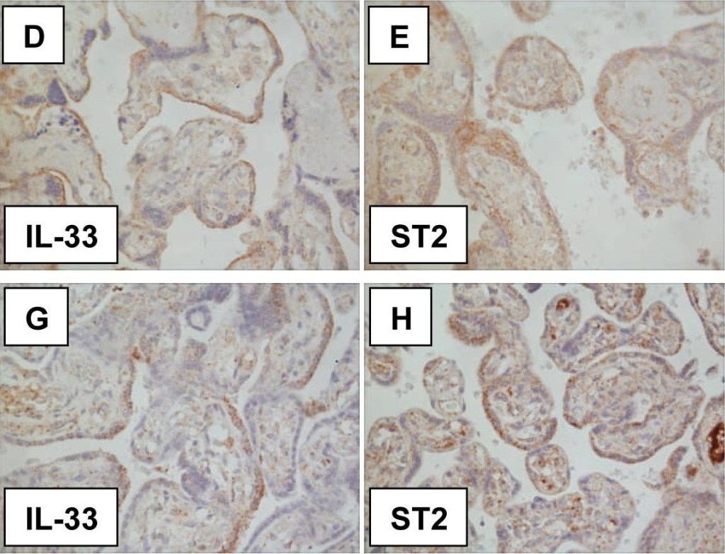 ALX-804-840 IL-33 monoclonal antibody (Nessy-1) Immunohistochemistry 1