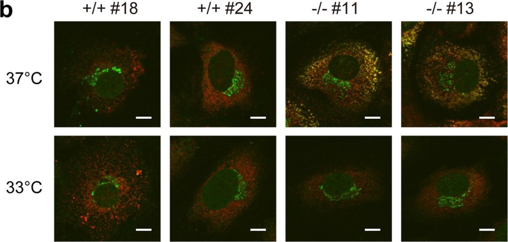 ADI-SPA-827 KDEL monoclonal antibody (10C3) Immunocytochemistry-Immunofluorescence Mouse 1