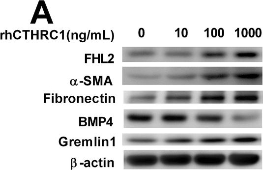 BML-FG6010 Fibronectin (cellular) (human) monoclonal antibody (DH1) Western Blot Human 3