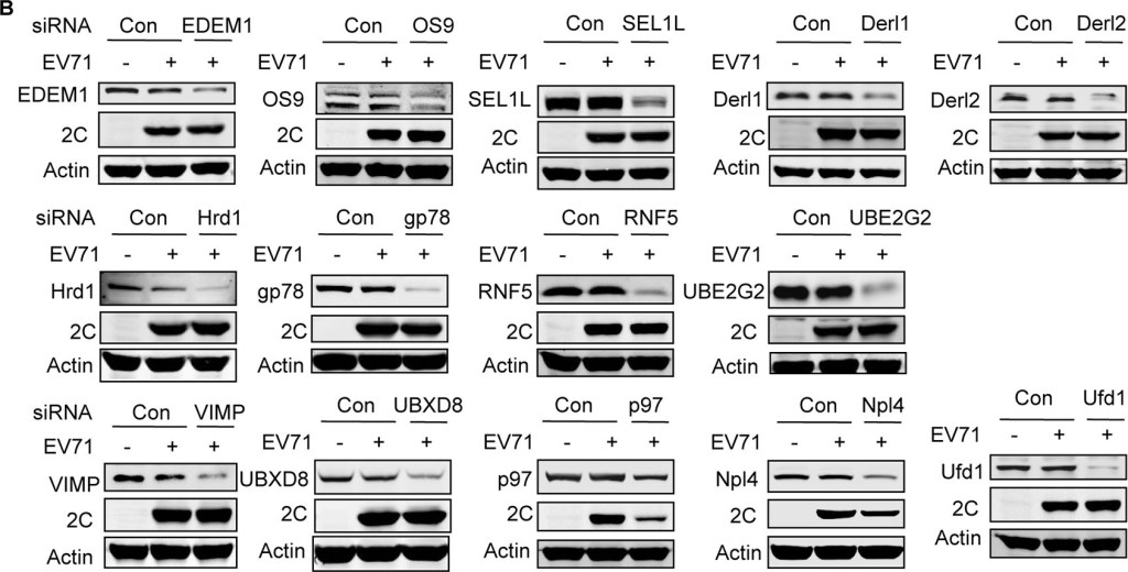 BML-PW9705 HERP (human) polyclonal antibody Western Blot Human 7