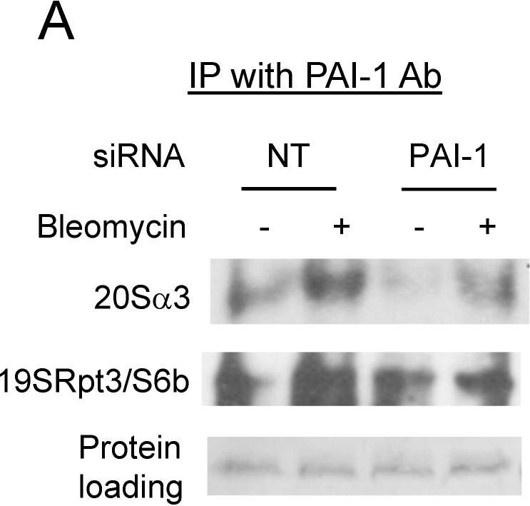BML-PW8765 Proteasome 19S Rpt3/S6b subunit monoclonal antibody (TBP7-27) Western Blot Human 1