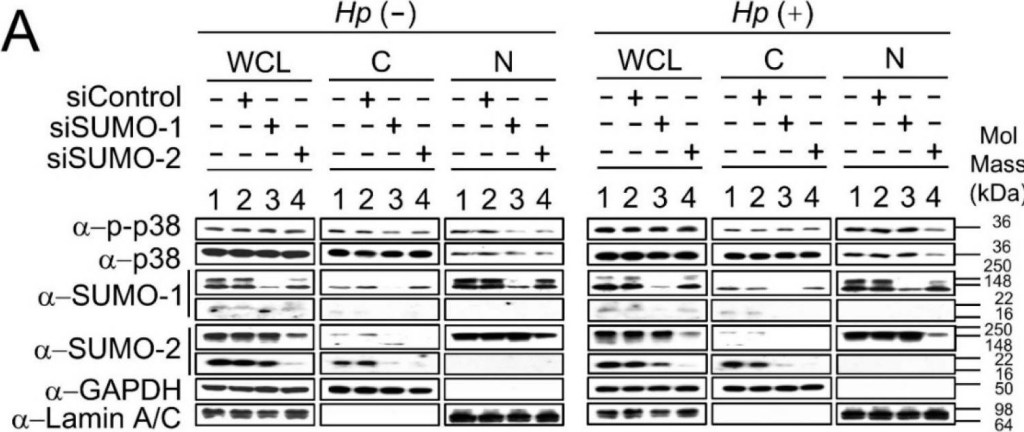 BML-PW9465 SUMO-2/3 (human) (NT) polyclonal antibody Western Blot Human 1