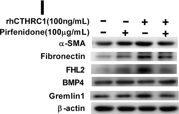 BML-FG6010 Fibronectin (cellular) (human) monoclonal antibody (DH1) Western Blot Human 4