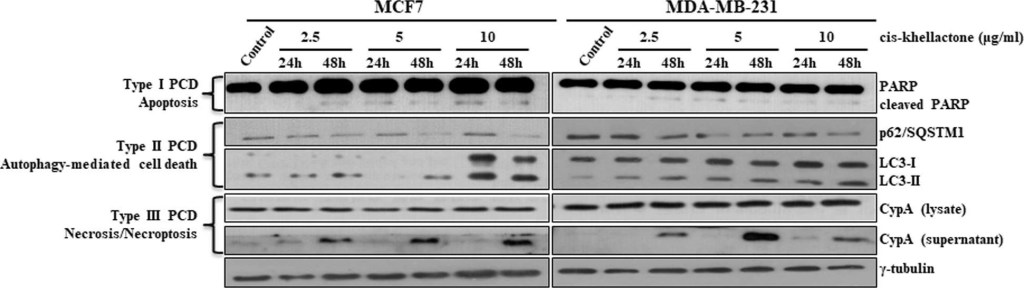 BML-SA296 Cyclophilin A polyclonal antibody Western Blot Human 1