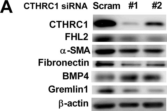BML-FG6010 Fibronectin (cellular) (human) monoclonal antibody (DH1) Western Blot Human 2