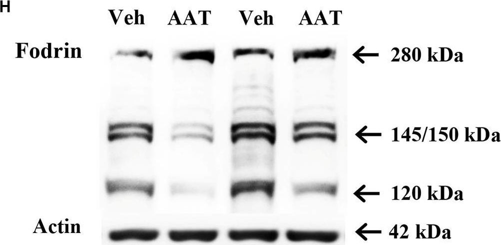 BML-FG6090 α Fodrin monoclonal antibody (AA6) Western Blot Mouse 5
