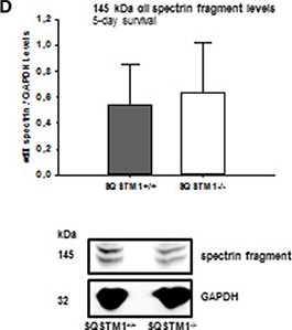 BML-FG6090 α Fodrin monoclonal antibody (AA6) Western Blot Mouse 2