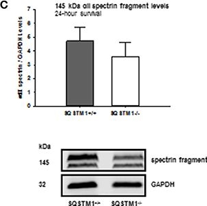 BML-FG6090 α Fodrin monoclonal antibody (AA6) Western Blot Mouse 1