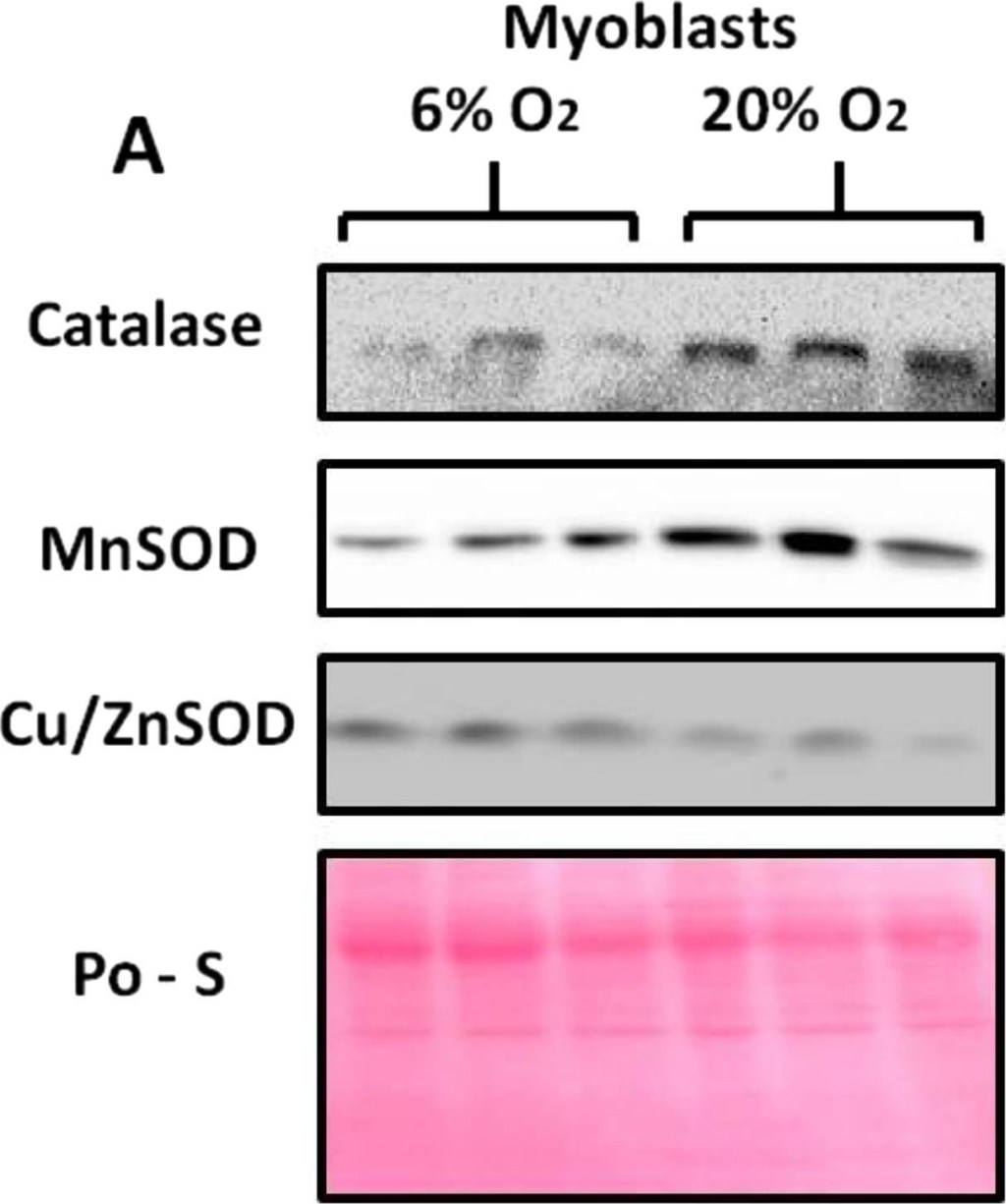 ADI-SOD-111 Mn SOD polyclonal antibody Western Blot Mouse 1