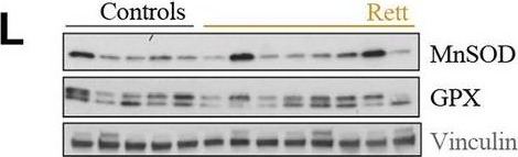 ADI-SOD-111 Mn SOD polyclonal antibody Western Blot Human 1