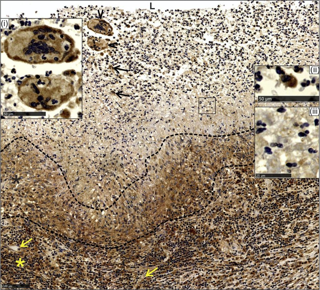 ADI-SPA-895 HO-1 polyclonal antibody Immunohistochemistry Mouse 1