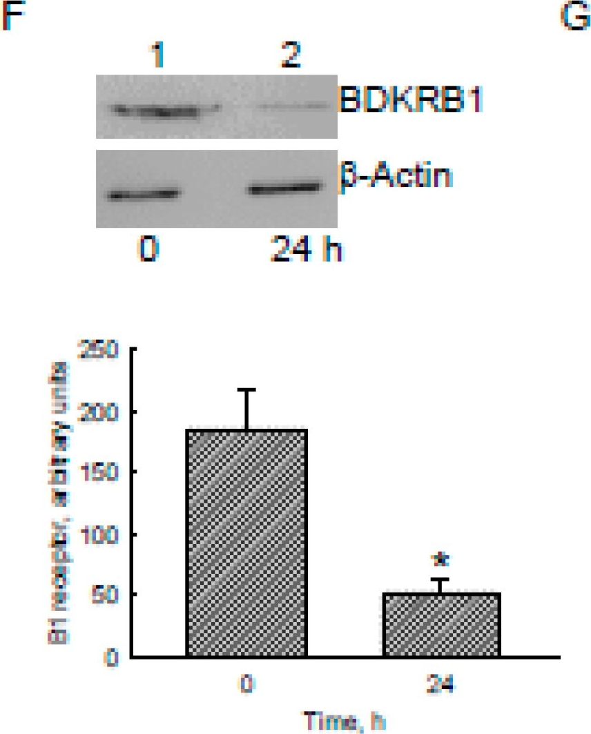 ADI-905-787 Bradykinin receptor B1 polyclonal antibody Western Blot Human 2