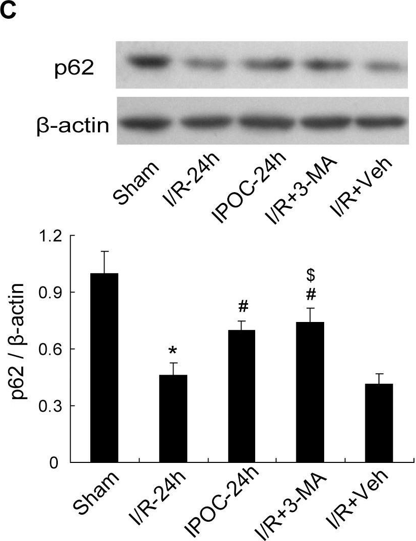 BML-PW9860 p62 (human) polyclonal antibody Western Blot 1