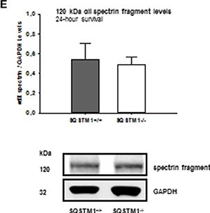 BML-FG6090 α Fodrin monoclonal antibody (AA6) Western Blot Mouse 3