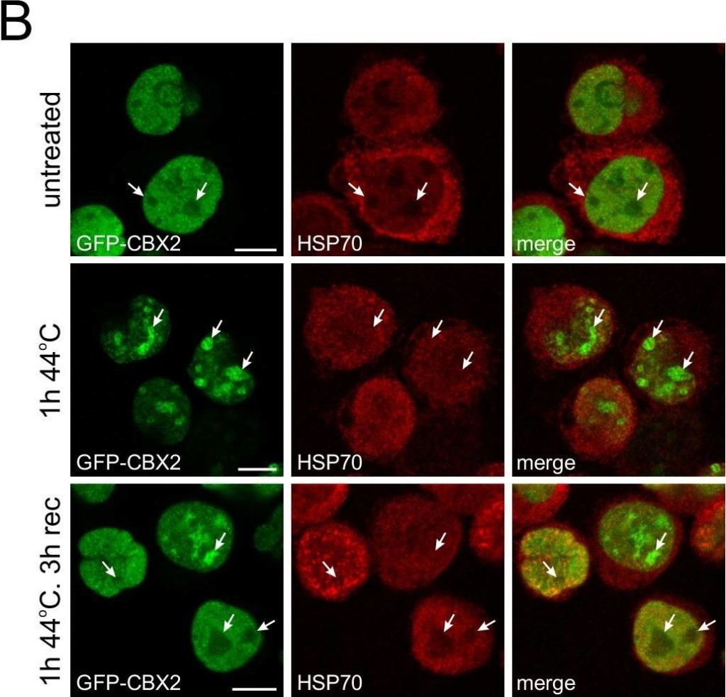 ADI-SPA-810 HSP70/HSP72 monoclonal antibody (C92F3A-5) Immunocytochemistry-Immunofluorescence Human 1