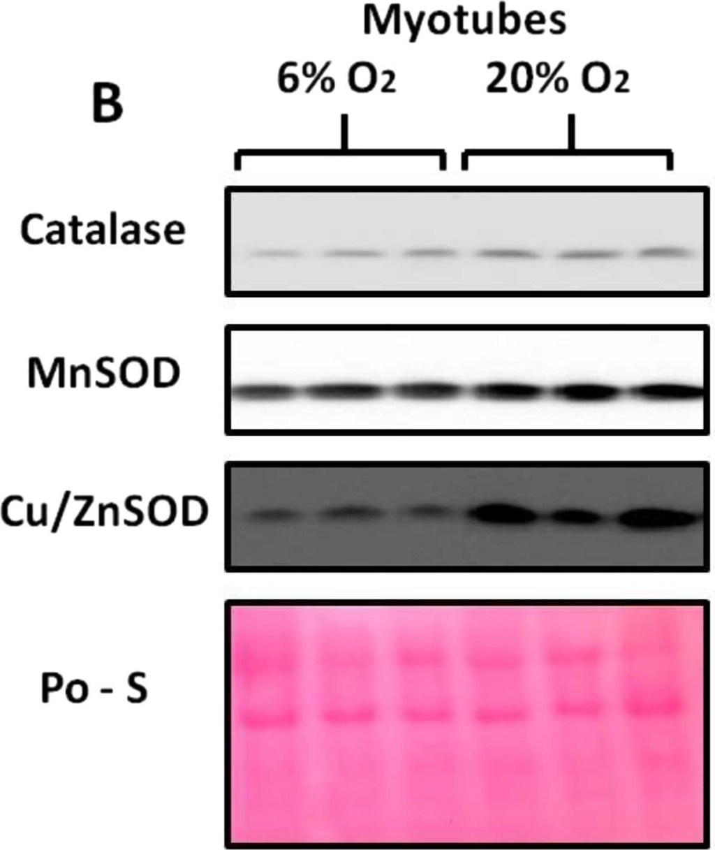 ADI-SOD-111 Mn SOD polyclonal antibody Western Blot Mouse 2