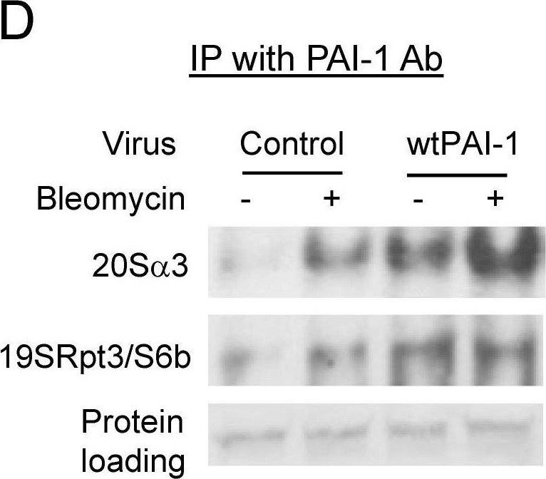 BML-PW8765 Proteasome 19S Rpt3/S6b subunit monoclonal antibody (TBP7-27) Western Blot Human 2