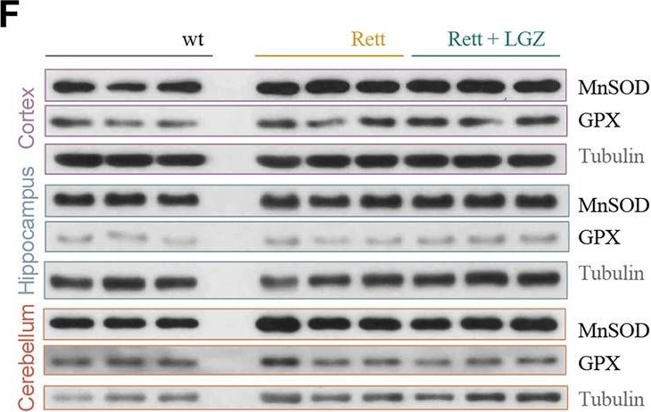 ADI-SOD-111 Mn SOD polyclonal antibody Western Blot Mouse 3