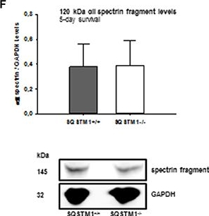 BML-FG6090 α Fodrin monoclonal antibody (AA6) Western Blot Mouse 4