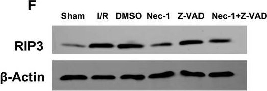 ADI-905-242 RIP3 polyclonal antibody Western Blot Rat 1
