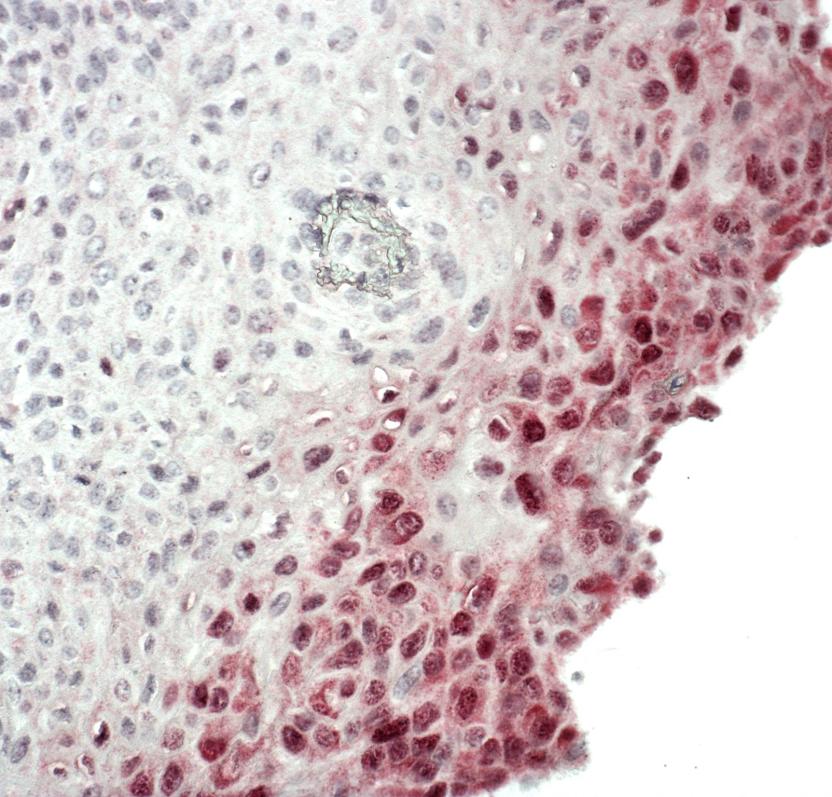 ish - in situ hybridization