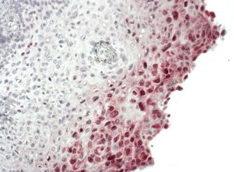 ish - in situ hybridization