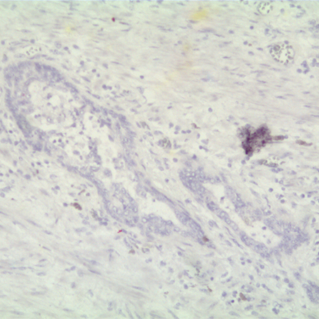 AMPIVIEW Ubiquitin (AS) Dig RNA Probes Set Prostate tissue no signal
