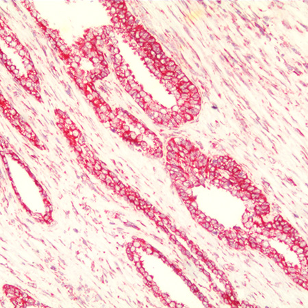 AMPIVIEW GAPDH (AS) Dig RNA Probes Set in Prostate Tissue