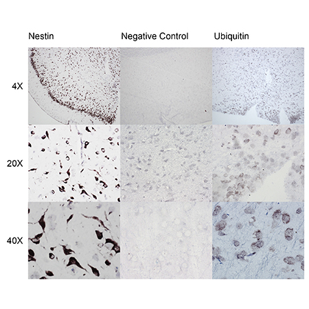 AMPIVIEW Nestin (AS) Dig RNA Probes (Rat) Set Rat Brain Ubiquitin