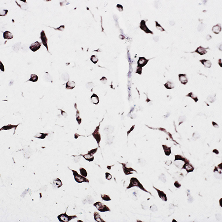 AMPIVIEW Nestin (AS) Dig RNA Probes (Rat) Set Rat Brain
