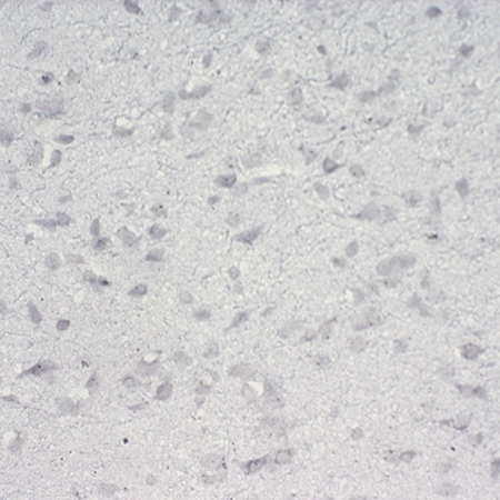 AMPIVIEW Nestin (AS) Dig RNA Probes (Rat) Set Rat Brain No Probe