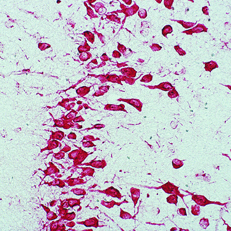 AMPIVIEW NORAD (AS) Dig RNA Probes (Mouse) Set Rat Brain