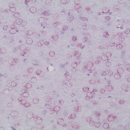 AMPIVIEW™ Circ018 (AS) Dig RNA Probes (Mouse) Set Mouse brain SHAM 4